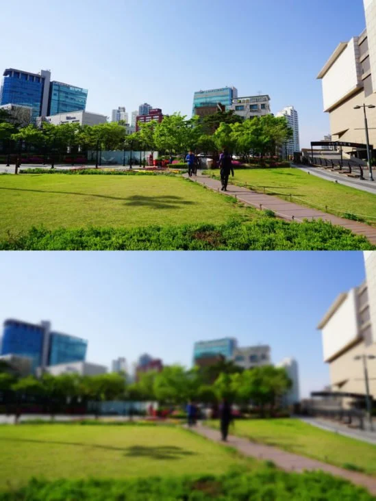 사진으로 보는 다양한 눈의 장애(백내장)