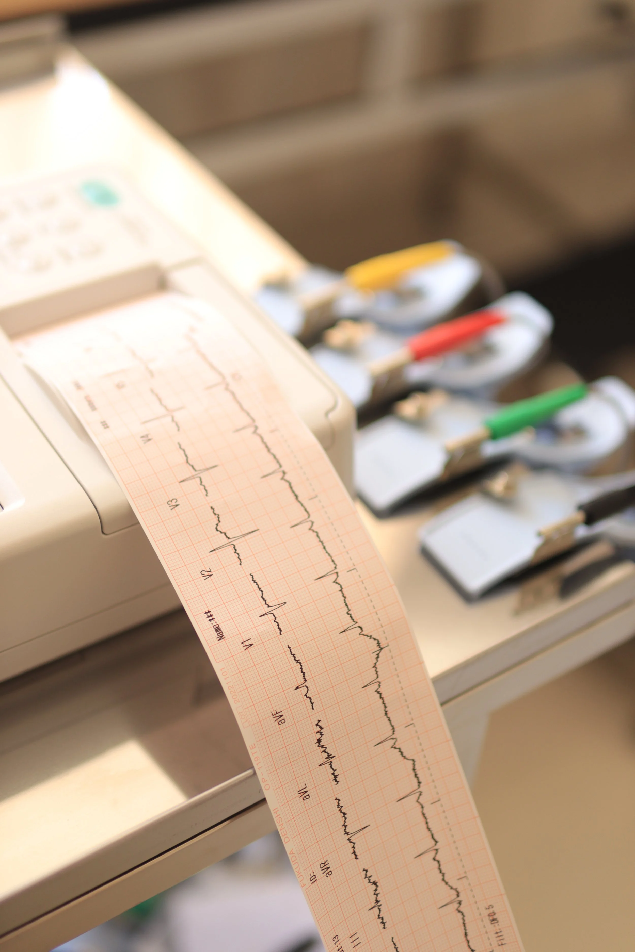 ecg.jpg