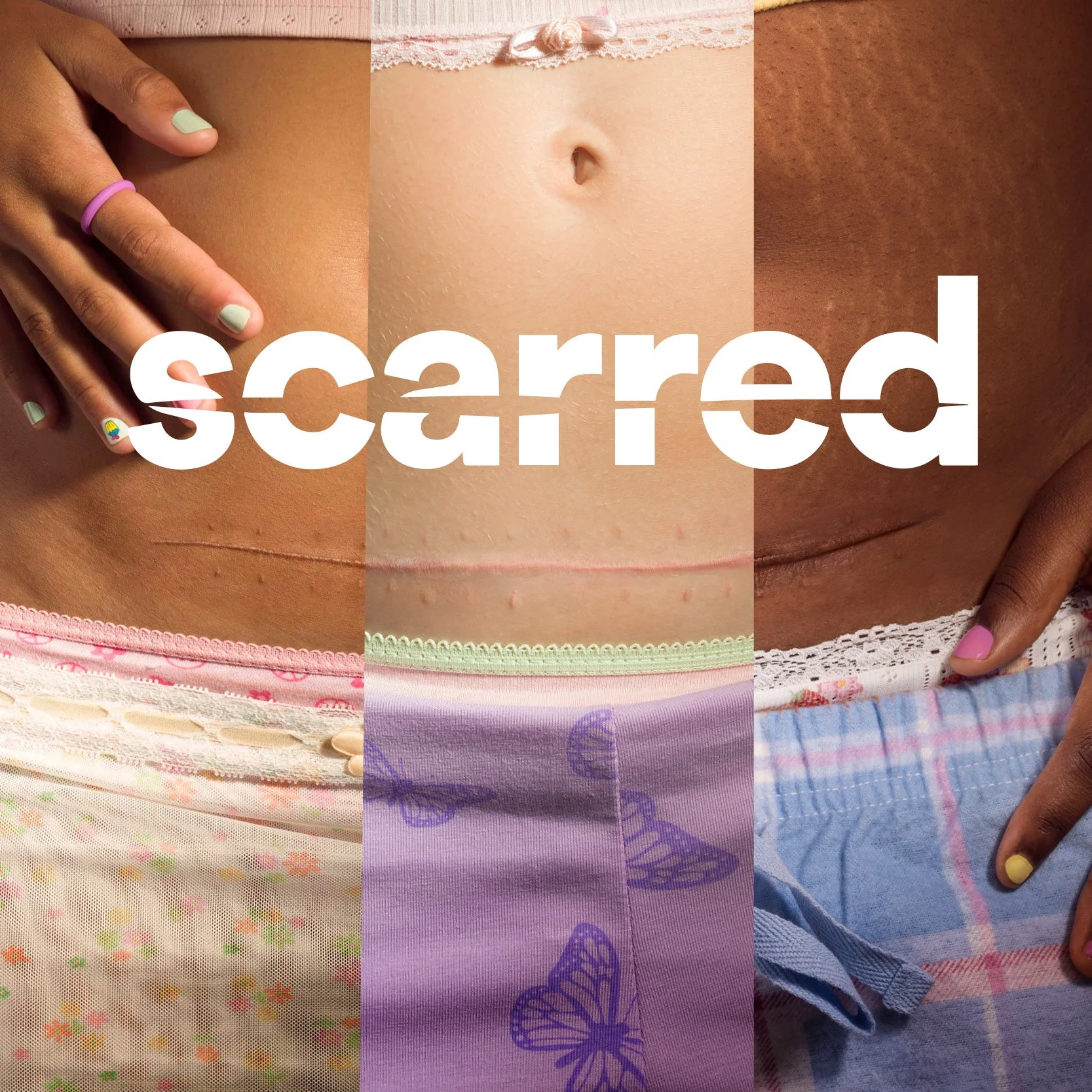 SCAN THE SCAR_scarred_icon 800x800.jpg