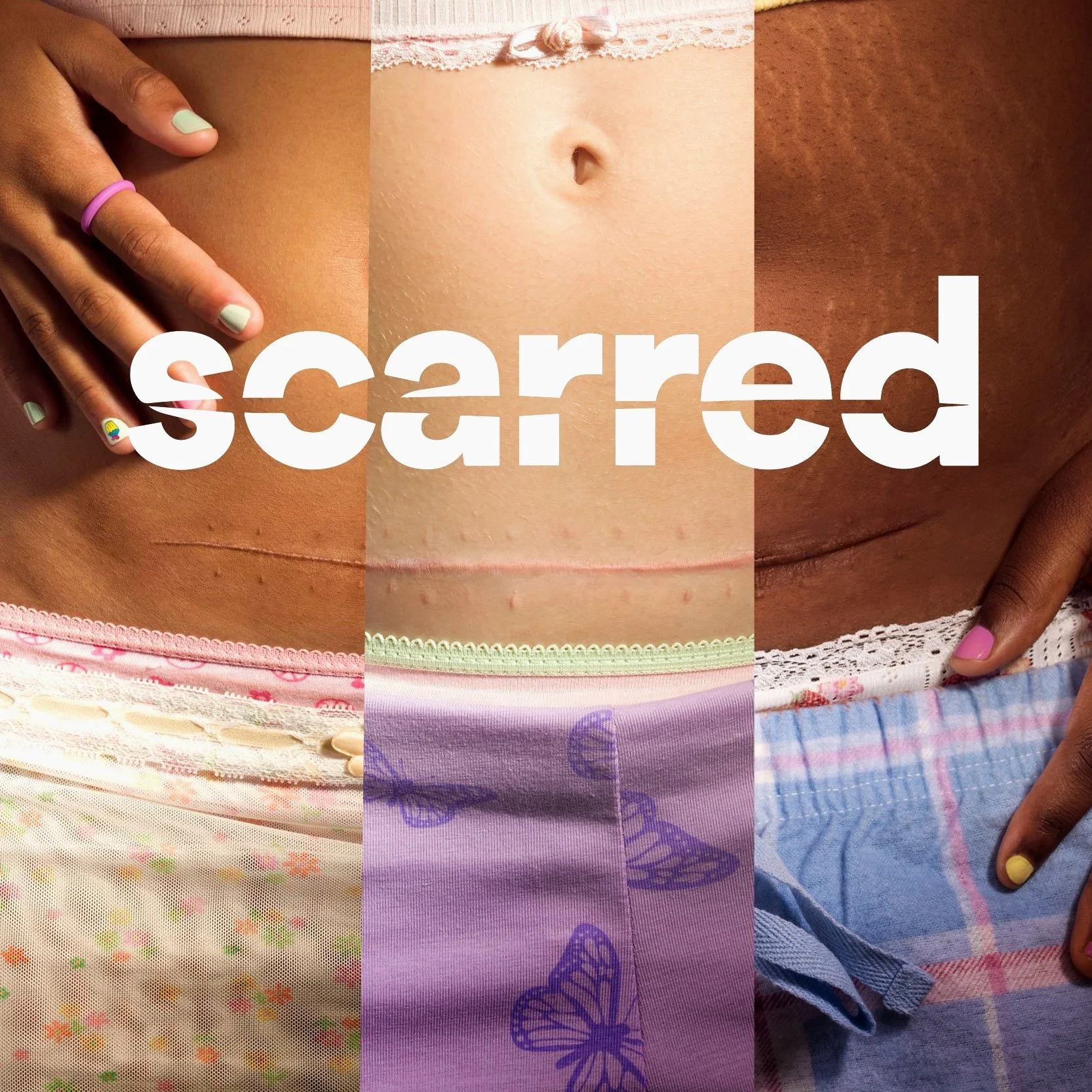 Scarred