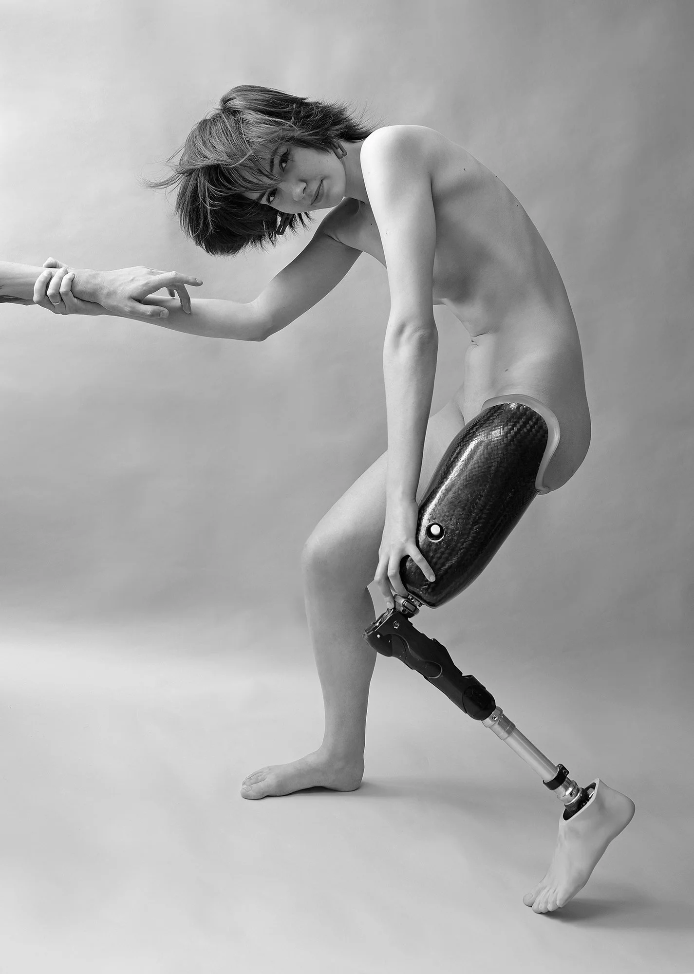 Michael Dorohovich - Life On A Prosthesis - Ukraine