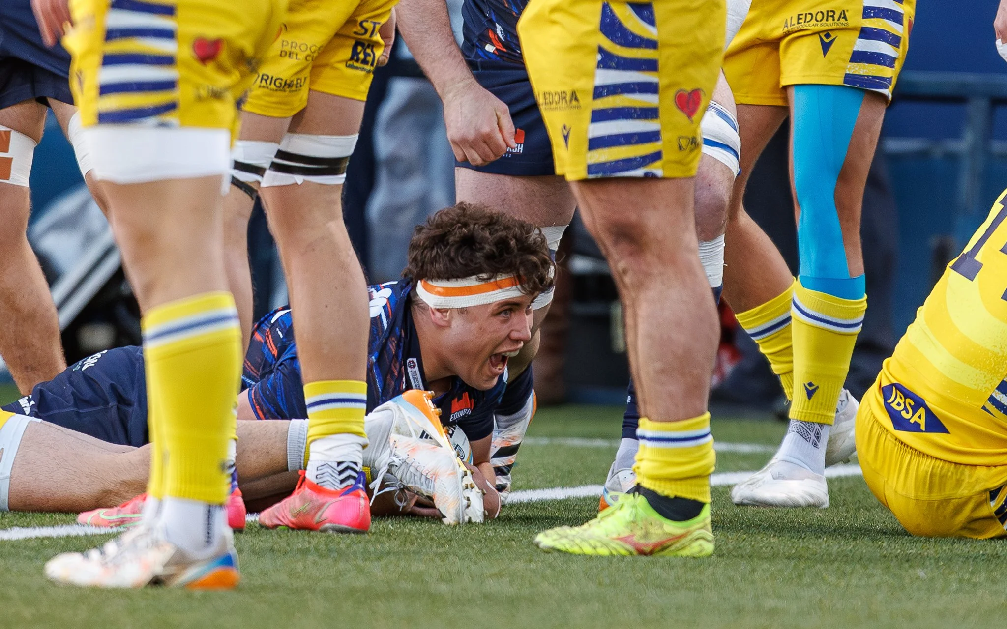 A group of rugby players standing and kneeling on the field, with one player lying on the ground. The players are wearing yellow and blue jerseys, with some wearing headbands, and are engaged in a game or practice.