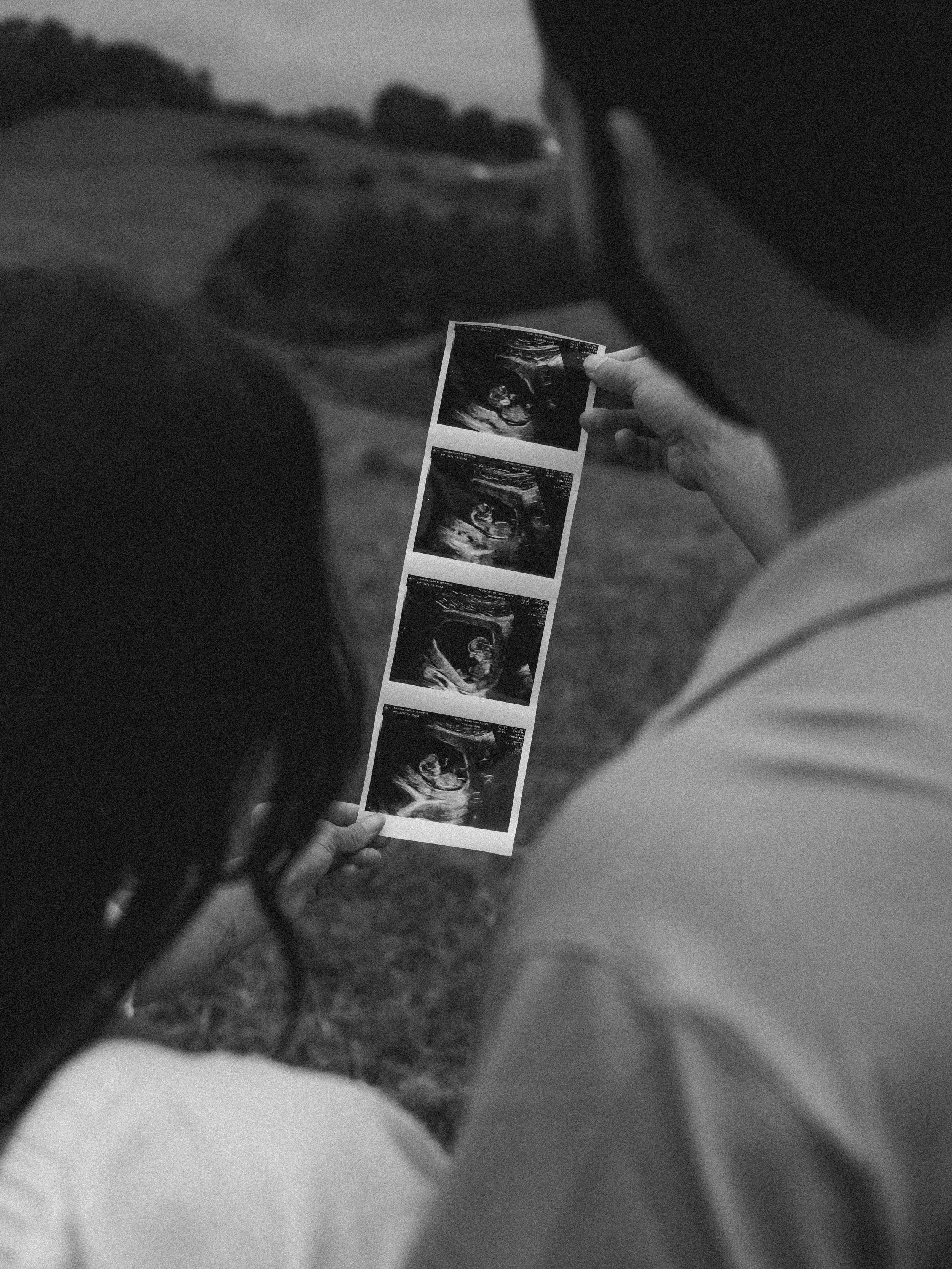Black and white photo of a person holding ultrasound images, with a blurred background.