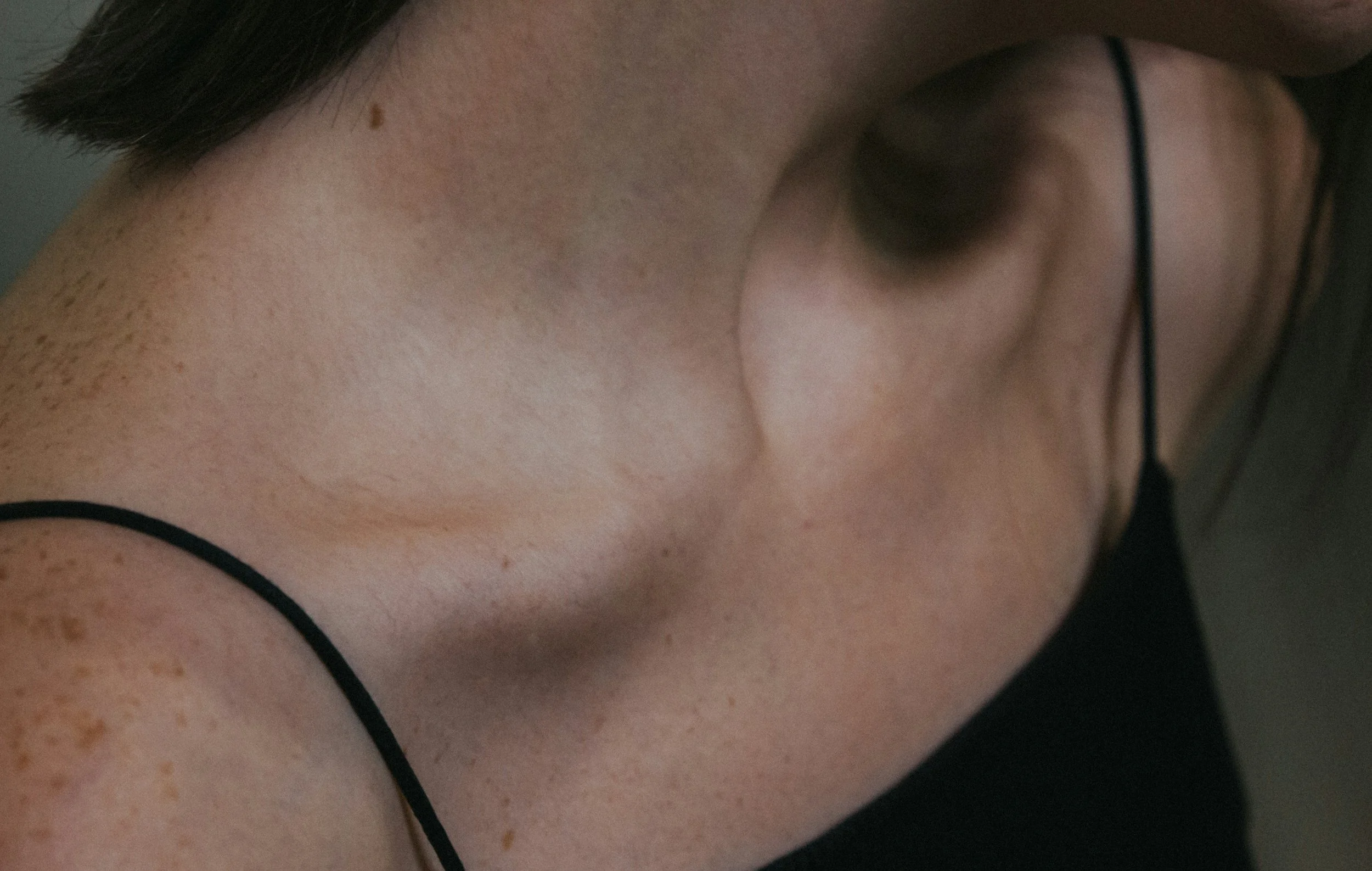 Close-up of a person’s shoulder and upper arm, wearing a black strap top, showing smooth skin with some freckles and a small mole.