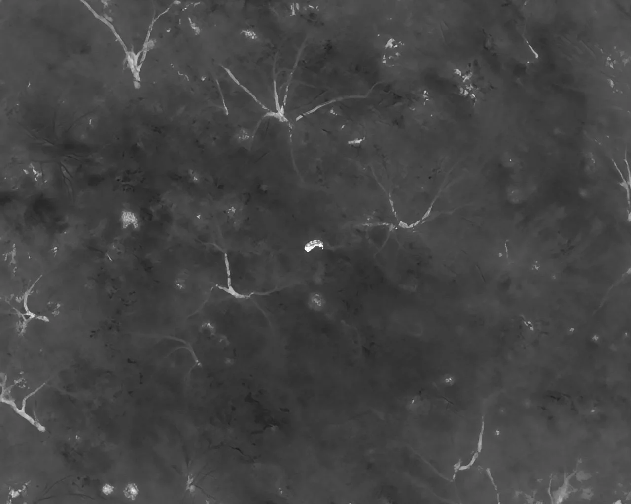 Black and white microscopic image of neural tissue showing cell bodies and connecting fibers.