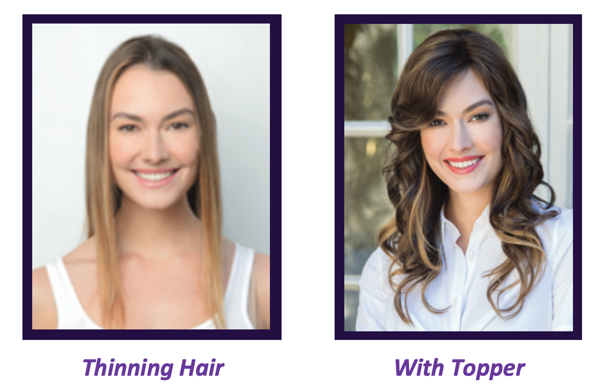 Comparison of two women, one with thin hair and one with fuller hair styled with a topper, both smiling.