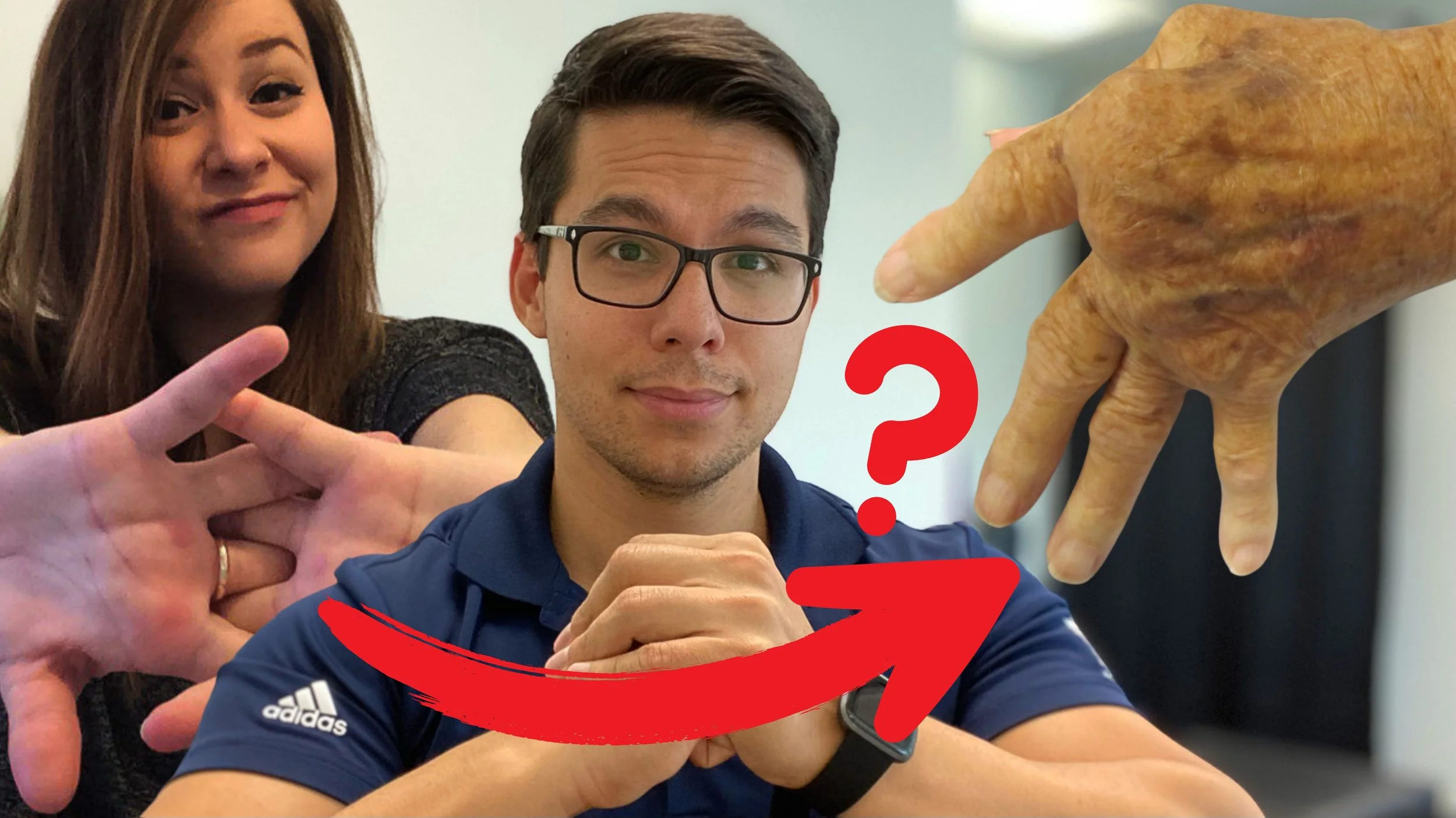 Is “Cracking” Your Knuckles Dangerous?