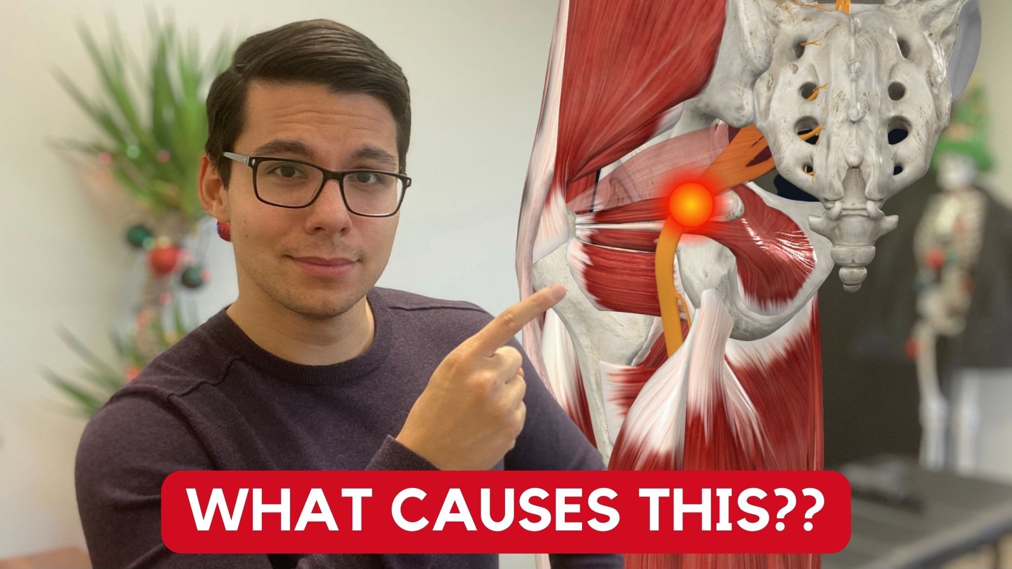 What’s Causing Your Sciatica?