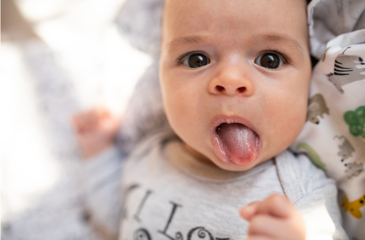 Is Tongue Tie Affecting             Your Child’s Eating?             What Every Parent Should Know.