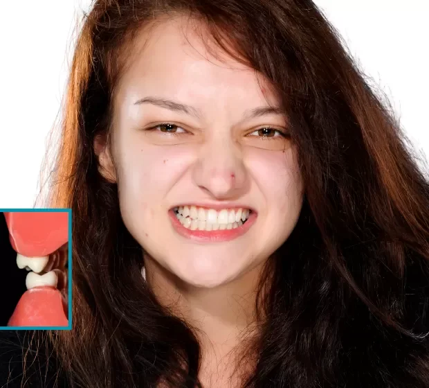 Close-up of a young woman with long dark hair, scrunching her face in an angry expression, showing her teeth, with a bright background. An inset shows a model of human teeth and gums.
