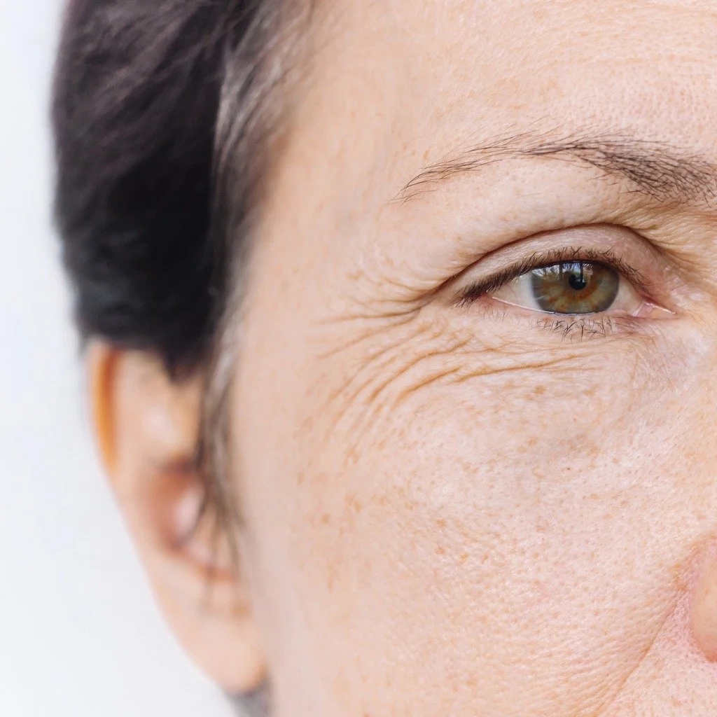 Close-up of a woman's face showing her right eye and surrounding skin with visible wrinkles and freckles.