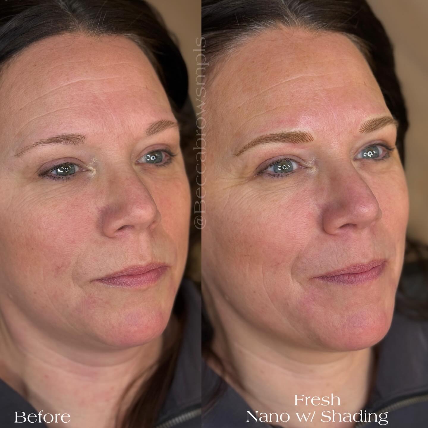 Fresh Nano
W/ Shading✨
By @Beccabrowsmpls

Sometimes I forget how much I love seeing a full face before and after. You can really see how impactful a shaped up brow is🥰

For all FAQs, pricing, and availability please visit my website at Beccabrows.c