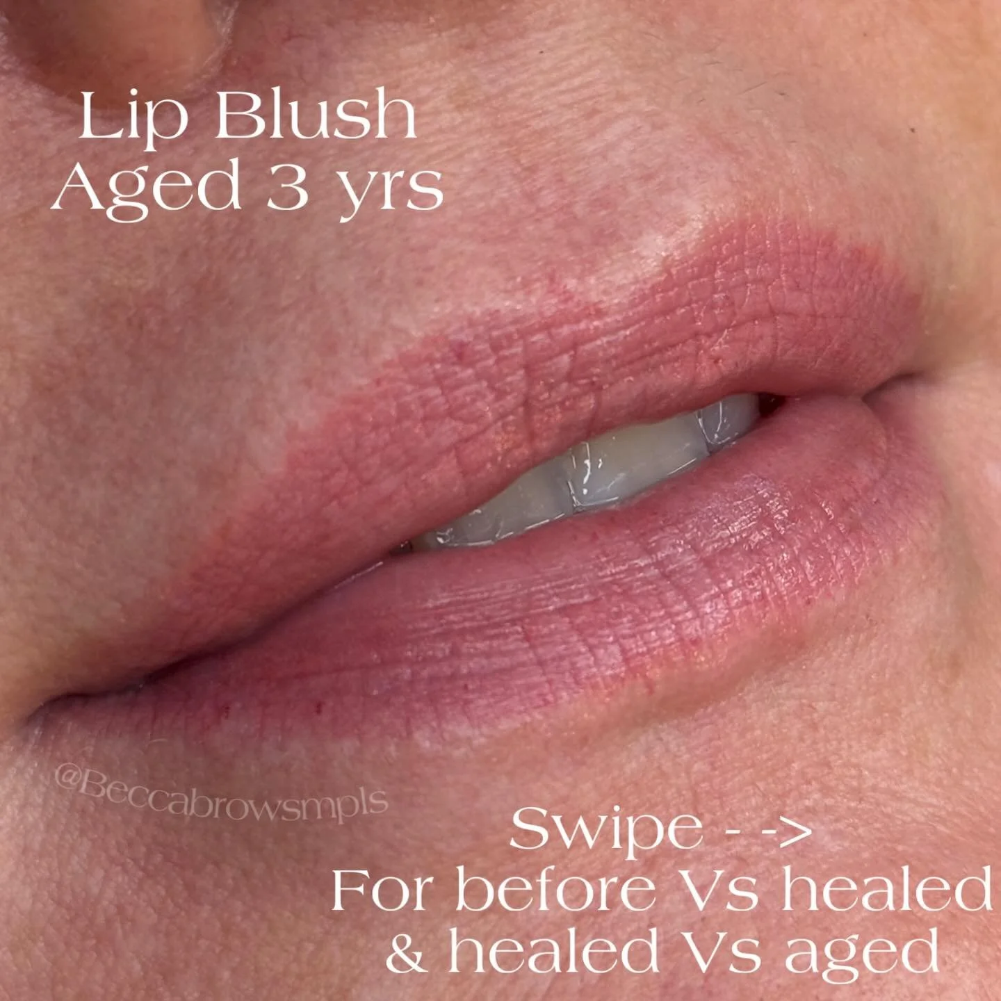 3 yrs Healed 
Lip Blush 💋
By @beccabrowsmpls 

This color faded so pretty, at her touch up we used the same color to brighten them a bit and fill in faded spots.

Colors Used: @mara.colors Brownie Pink/ 4 drops of Dark Strawberry 

For all FAQs, pri