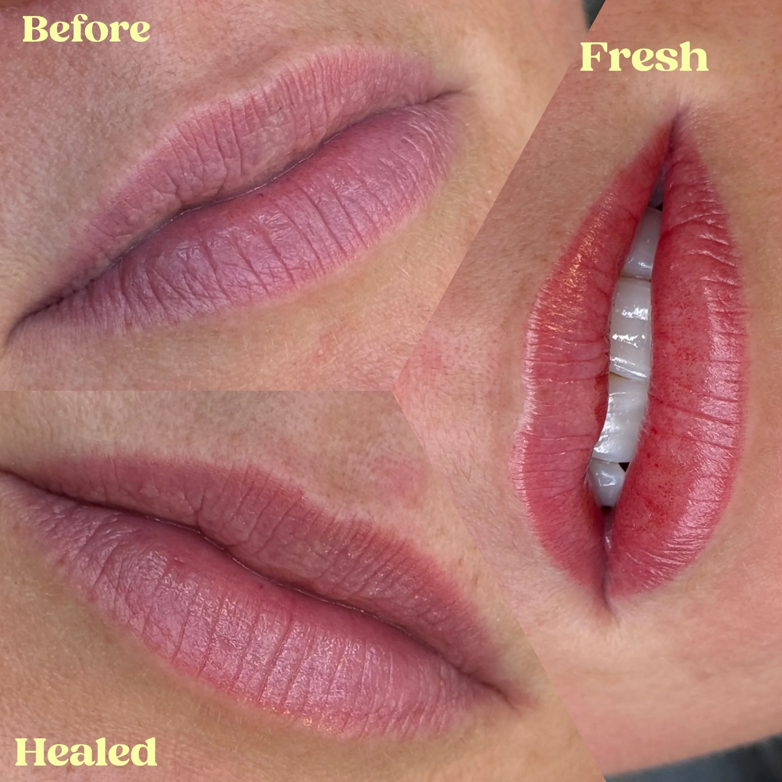 Healt Lip Blush!

Swipe for a closer look a before Vs Healed✨
Colors Used: @mara.colors Brownie Pink/ 7 Dark Strawberry/ 5 Choco Mauve

For all FAQs, pricing, and availability please visit my website at Beccabrows.com
Thank you!!

#lipblushtattoo #mi