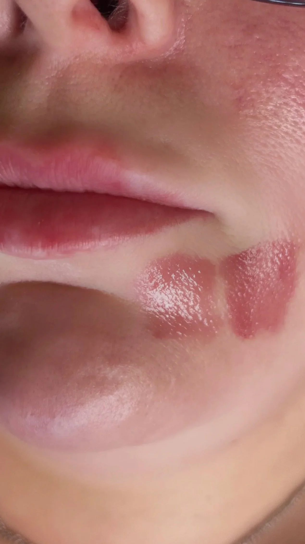 Close-up of a person's lips and a portion of their nose, with visible skin texture. Lip Blush