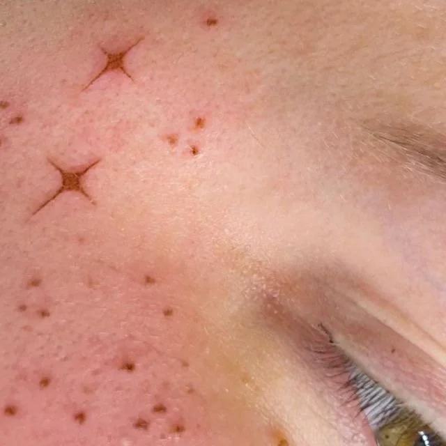 Faux Freckles, Freckles, Tattooed Freckles, Freckle tattoo, Newark, Heart freckle