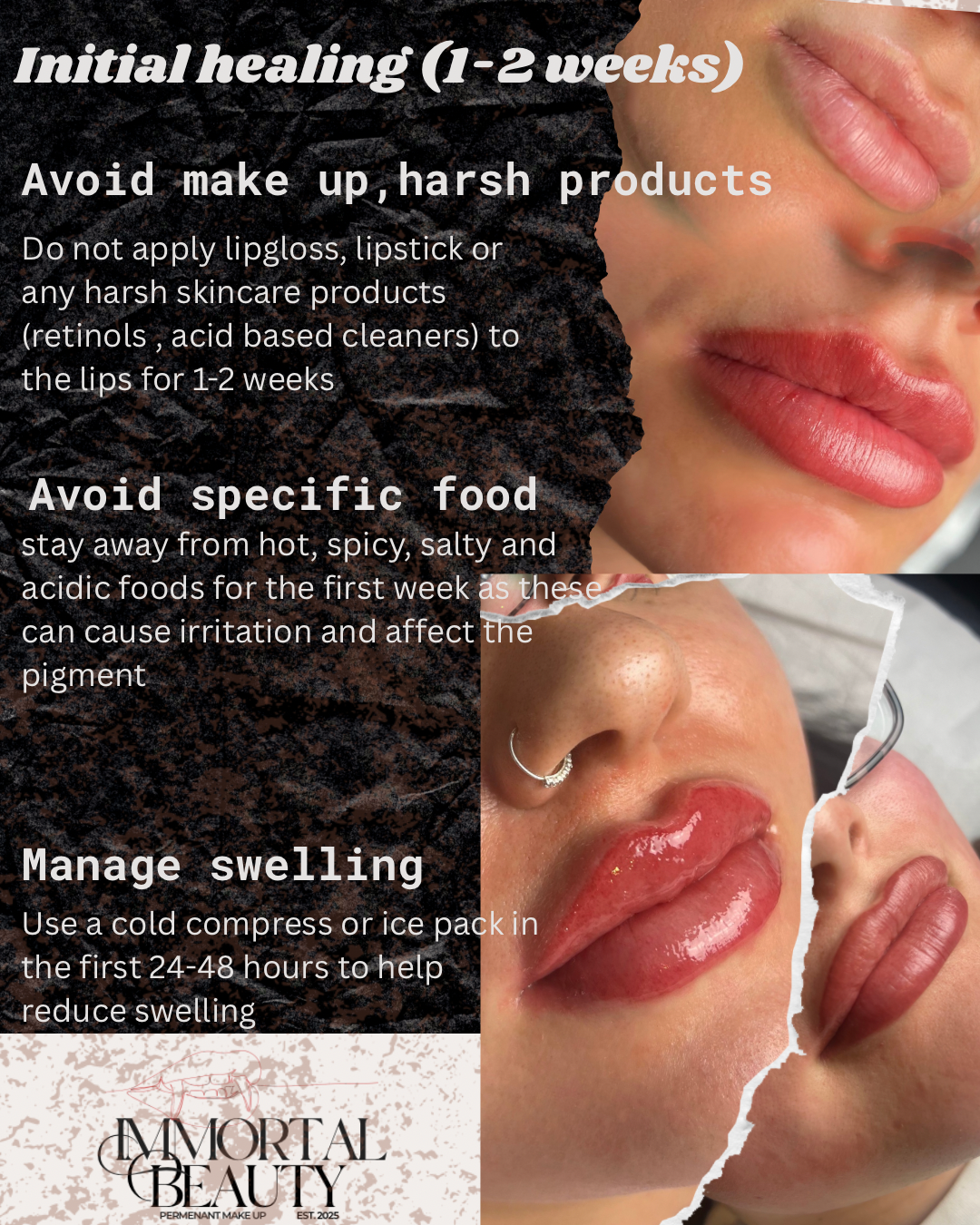 A skincare advice poster with images of lips showing healing progress, and text instructions for initial healing over 1-2 weeks, including avoiding harsh skincare products and specific foods, and managing swelling with cold compresses.