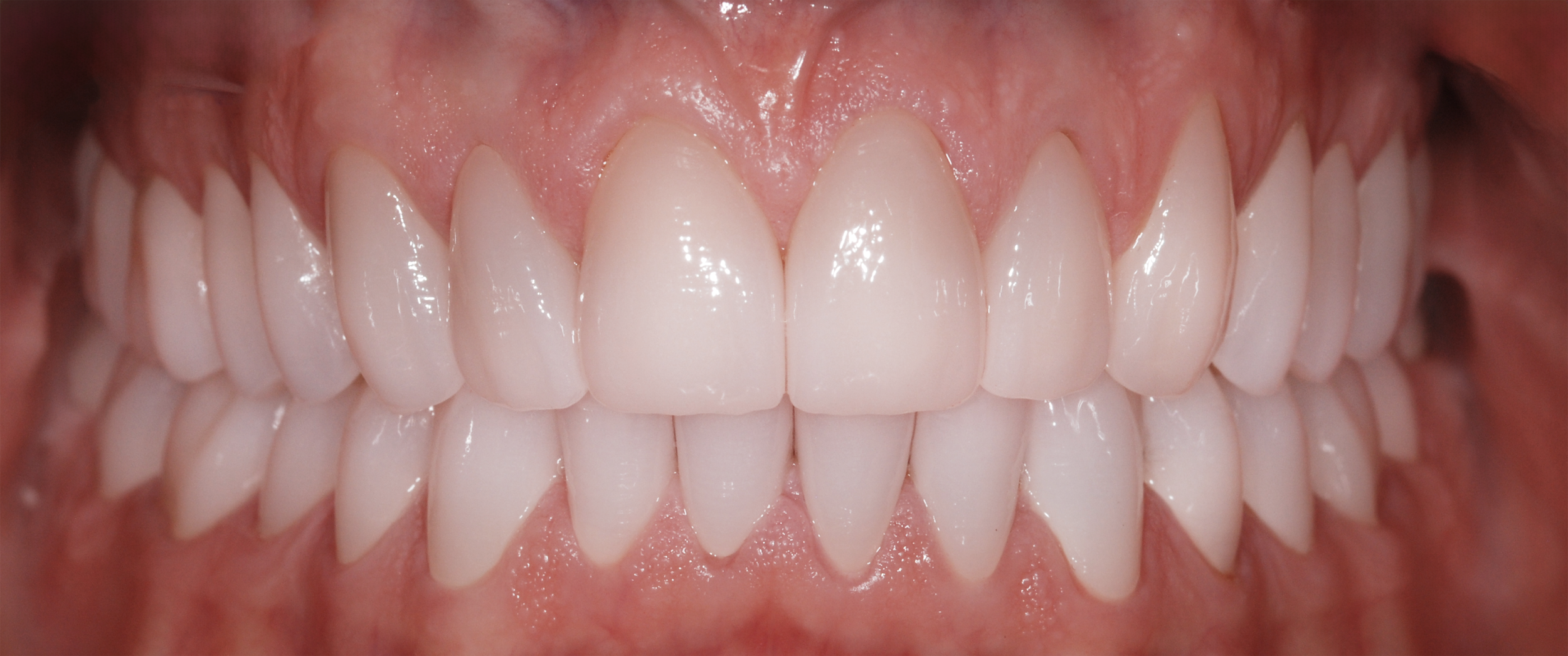 Premium aesthetic dental clinic for invisible aligners and smile correction in Berlin