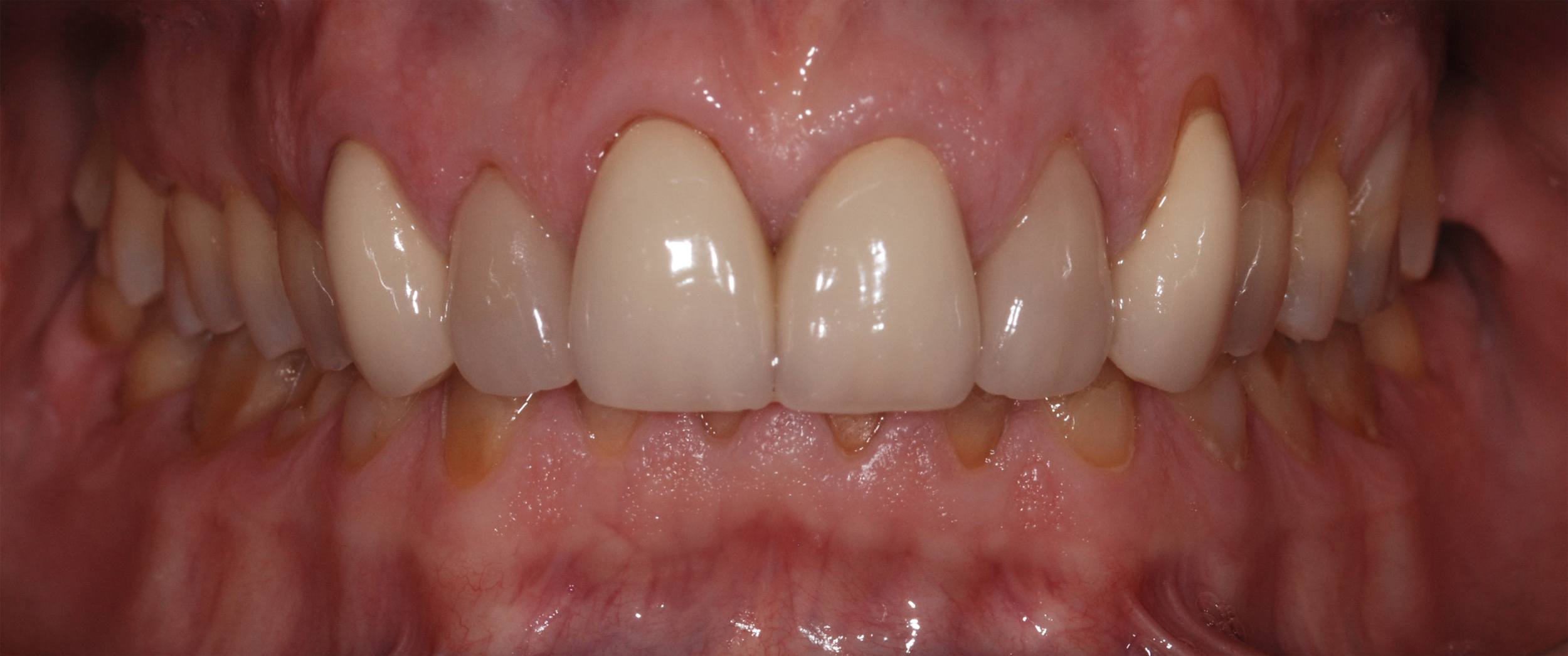 Premium aesthetic dental clinic for invisible aligners and smile correction in Berlin