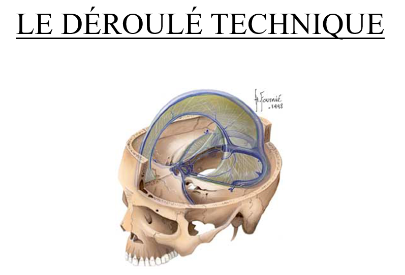 Schéma anatomique montrant une coupe du crâne humain avec des structures internes du cerveau, illustrant le processus de déploiement technique avec des annotations et un titre en français.