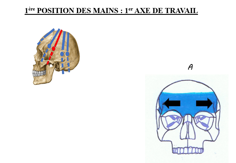 Schéma montrant la position des mains sur un crâne, avec des flèches indiquant un mouvement d'ouverture et de fermeture de la partie supérieure du crâne.
