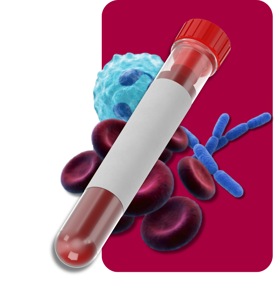 Sepsis Blood Diagnostic