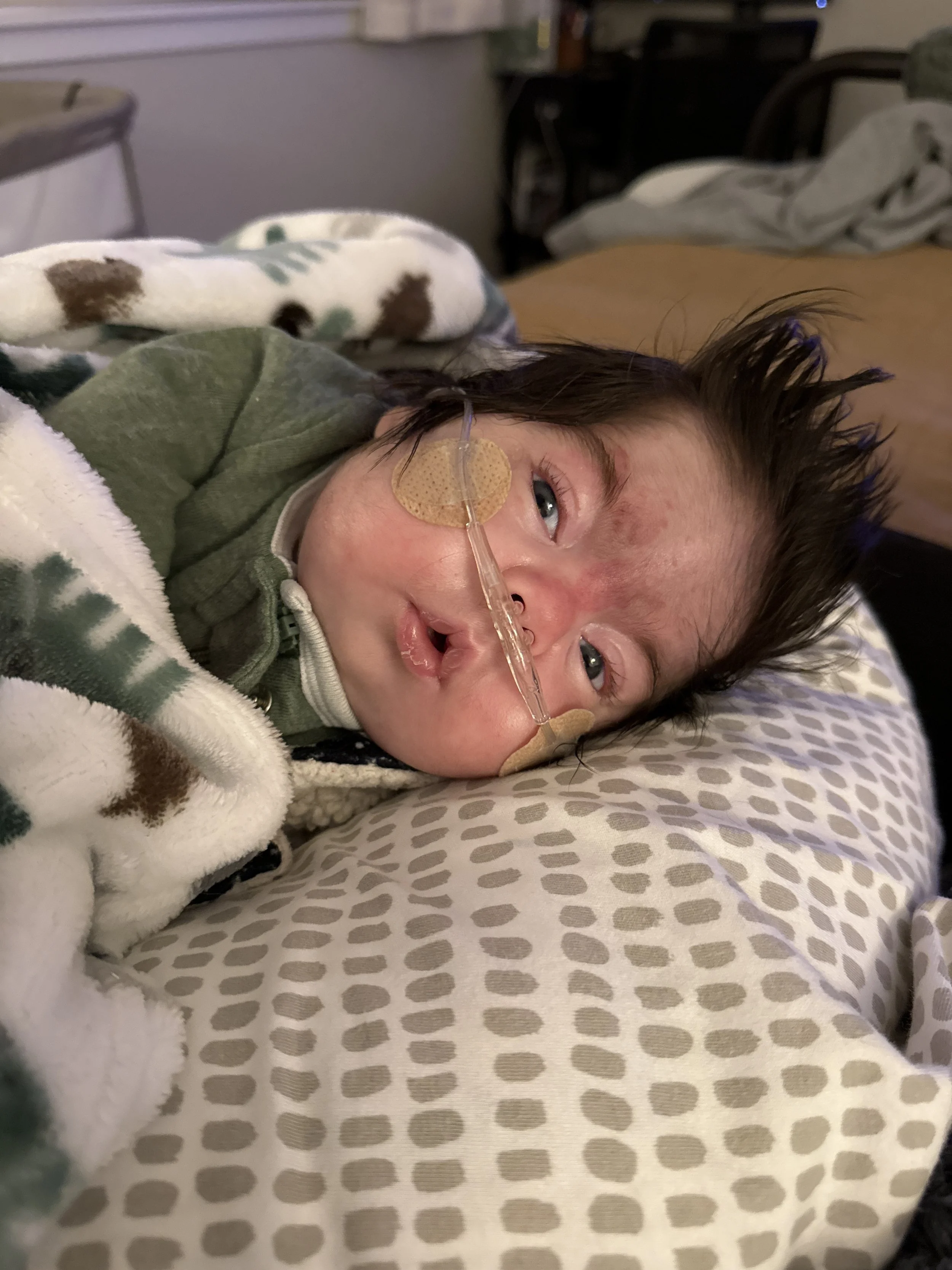 Young girl lying in bed with medical tube in her nose, wrapped in a blanket, looking towards the camera.