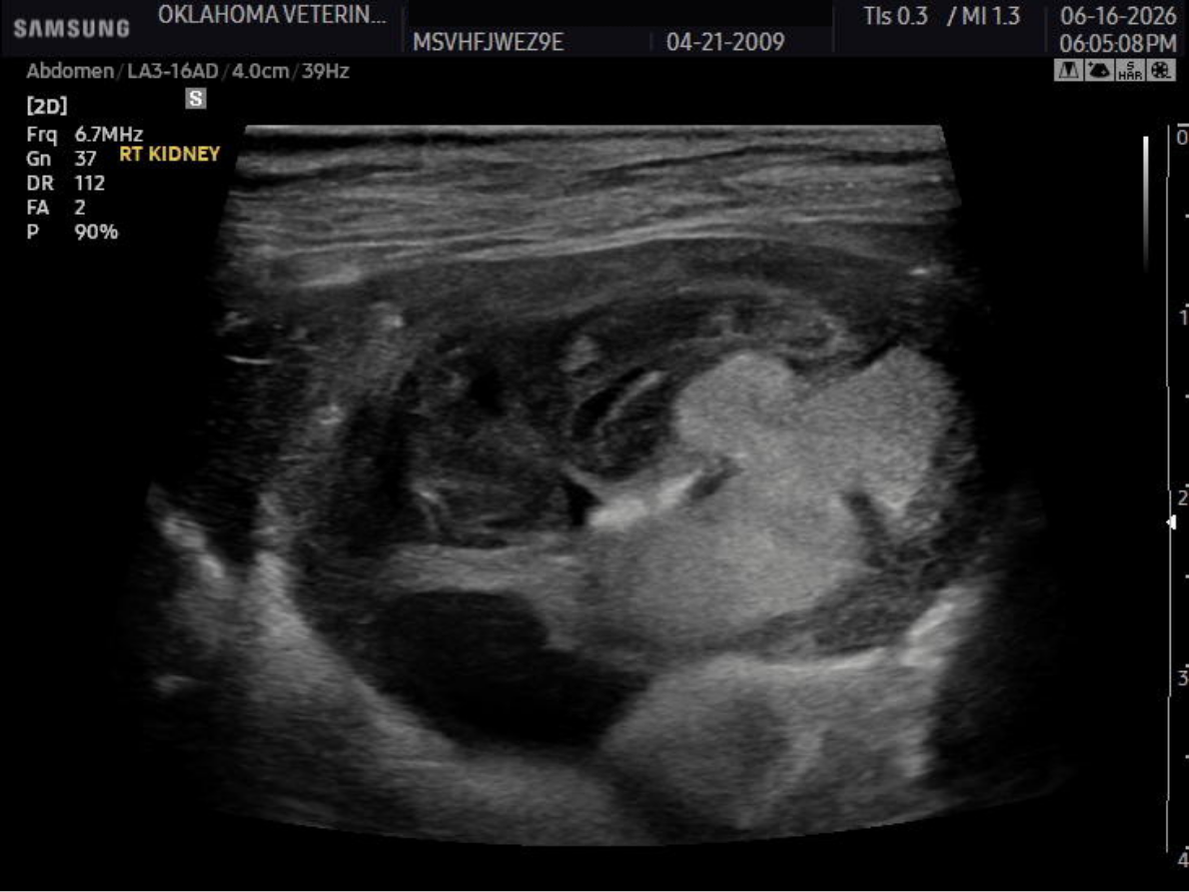 Right kidney mass