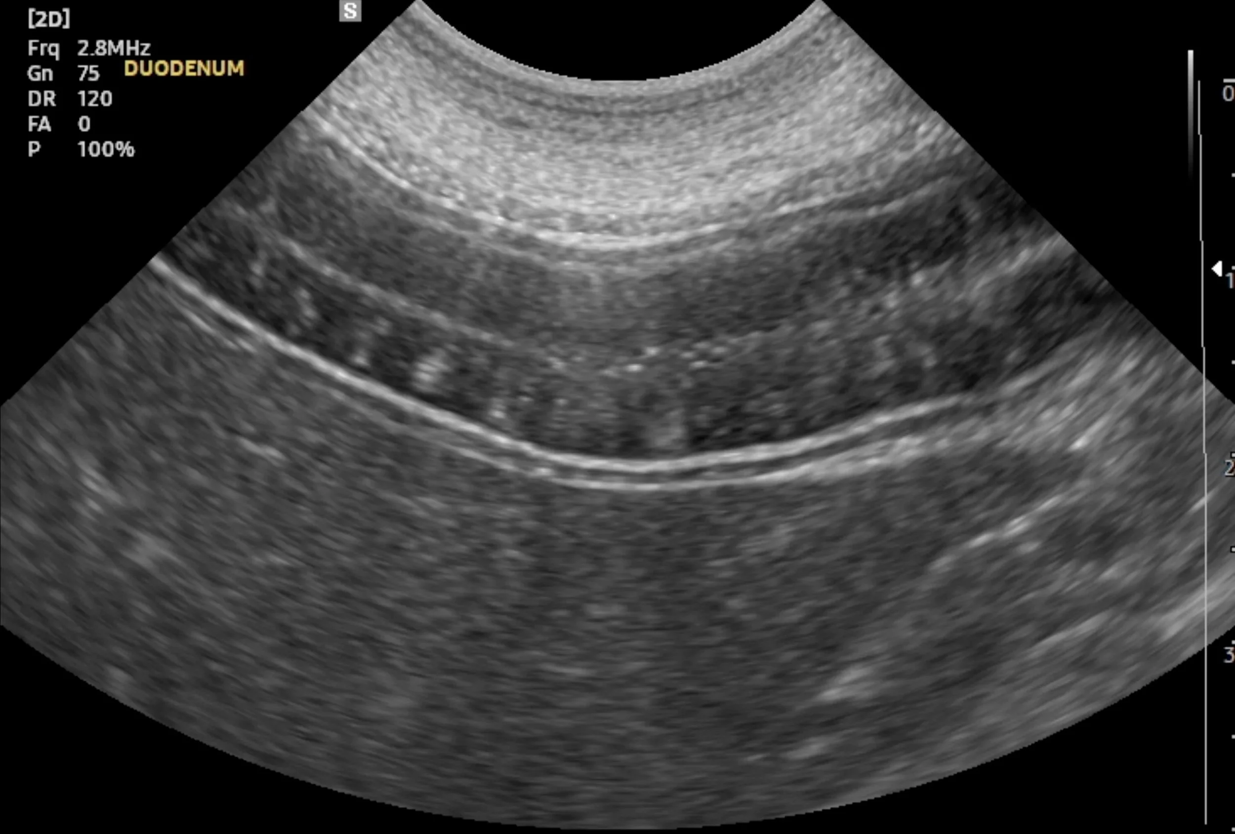 Case 01: Chronic Refractory Diarrhea in a French Bulldog