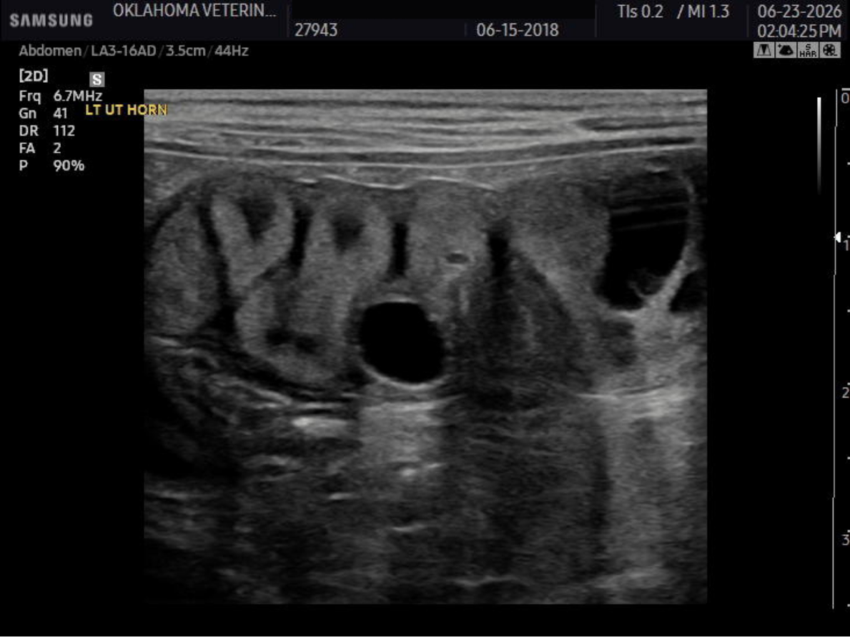 Cystic endometrial hyperplasia