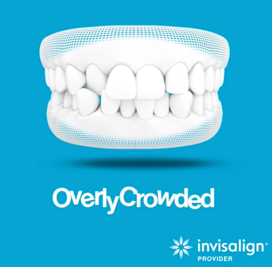 Invisalign Provider Ads