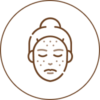 Illustration of a woman with acne-prone skin, showing a pimple on her cheek