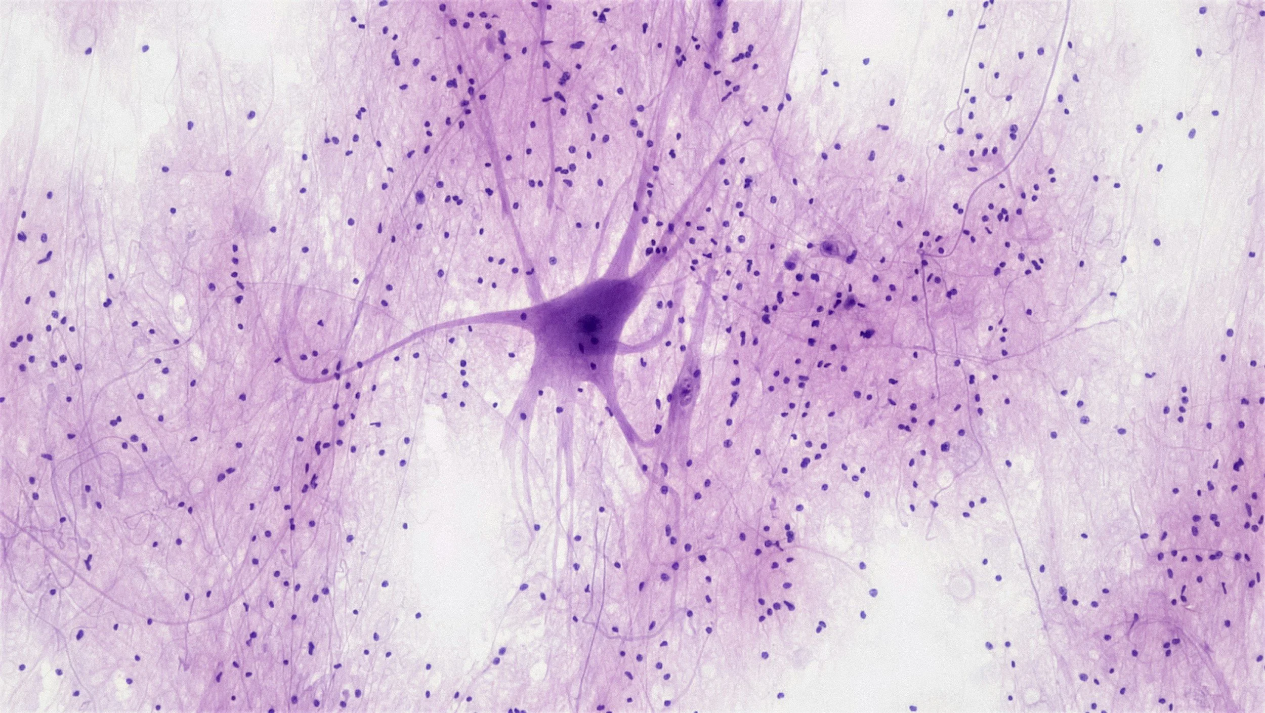 Microscopic view of a neuron with purple stained cell body and numerous purple dots representing cell nuclei, surrounded by a network of faint purple nerve fibers.