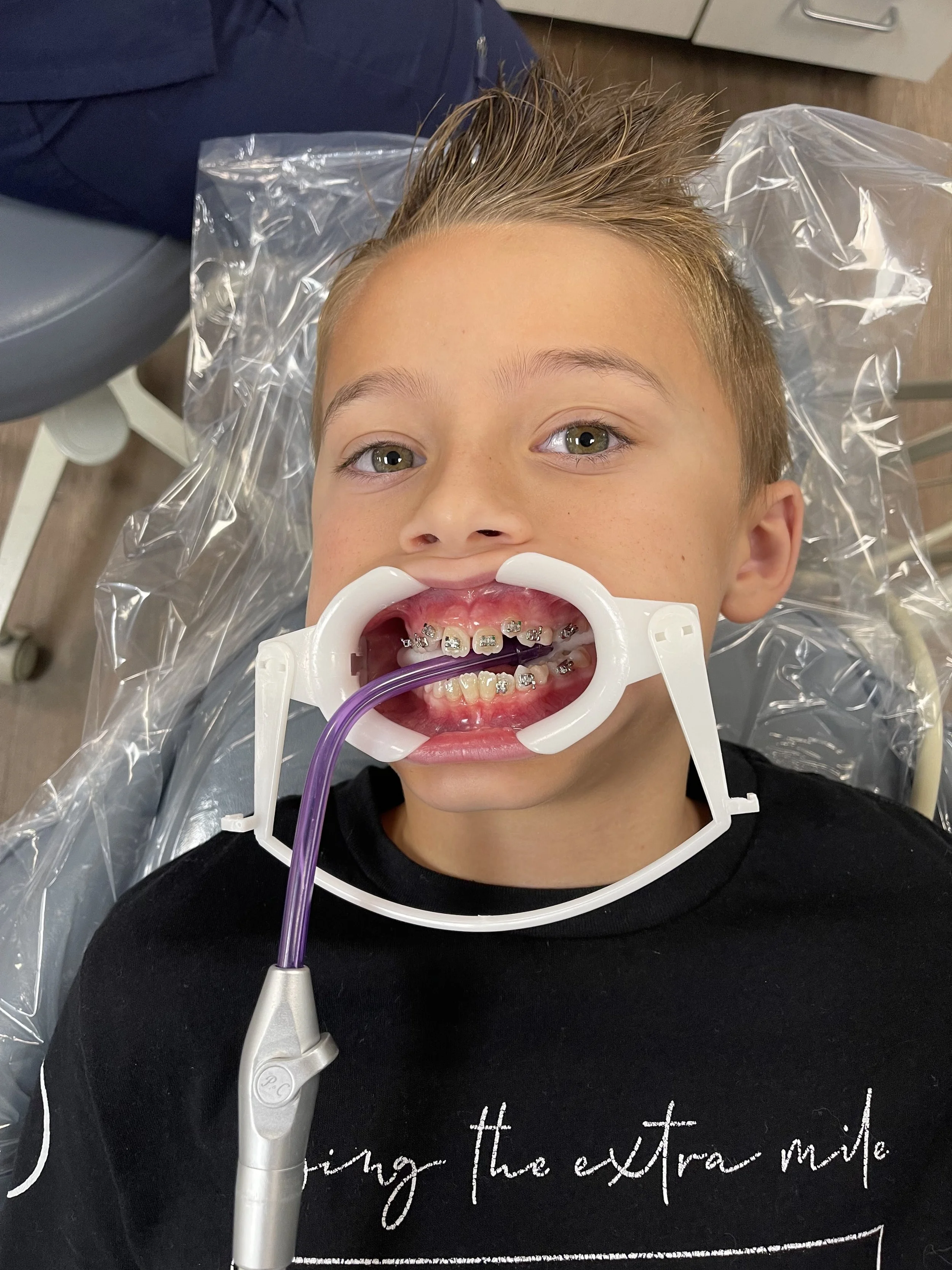 A young boy with braces lying back in a dental chair, with a cheek retractor in his mouth and dental tools around him at the dentist's office.