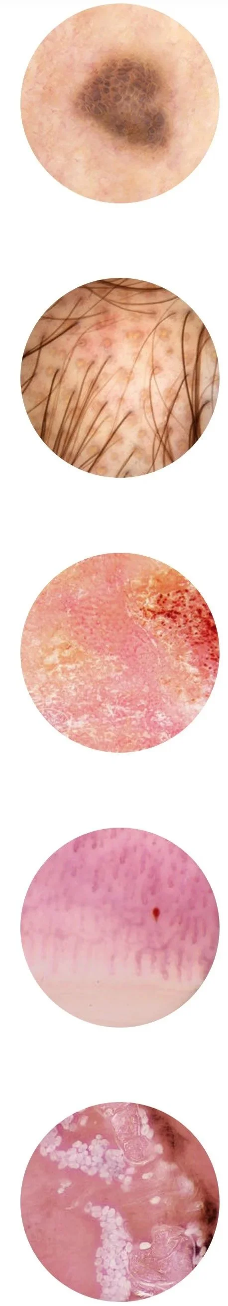 Close-up images of skin conditions, including a dark mole or melanoma, inflamed skin with hair follicles, irritated skin with redness, a pink rash, and a skin sample possibly showing cysts or nodules.