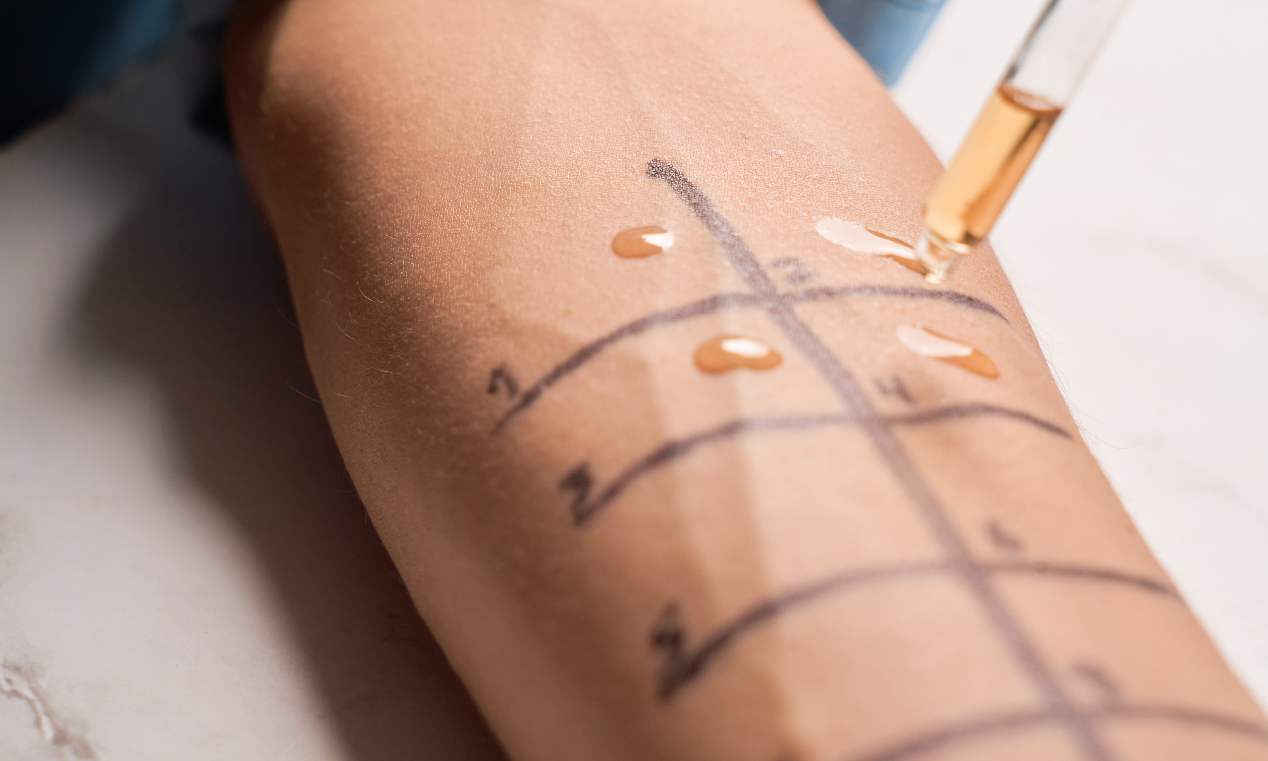 Close-up of a person's arm with black lines and numbers drawn on it, a syringe with a clear liquid is injecting into the arm, with drops of liquid on the skin.