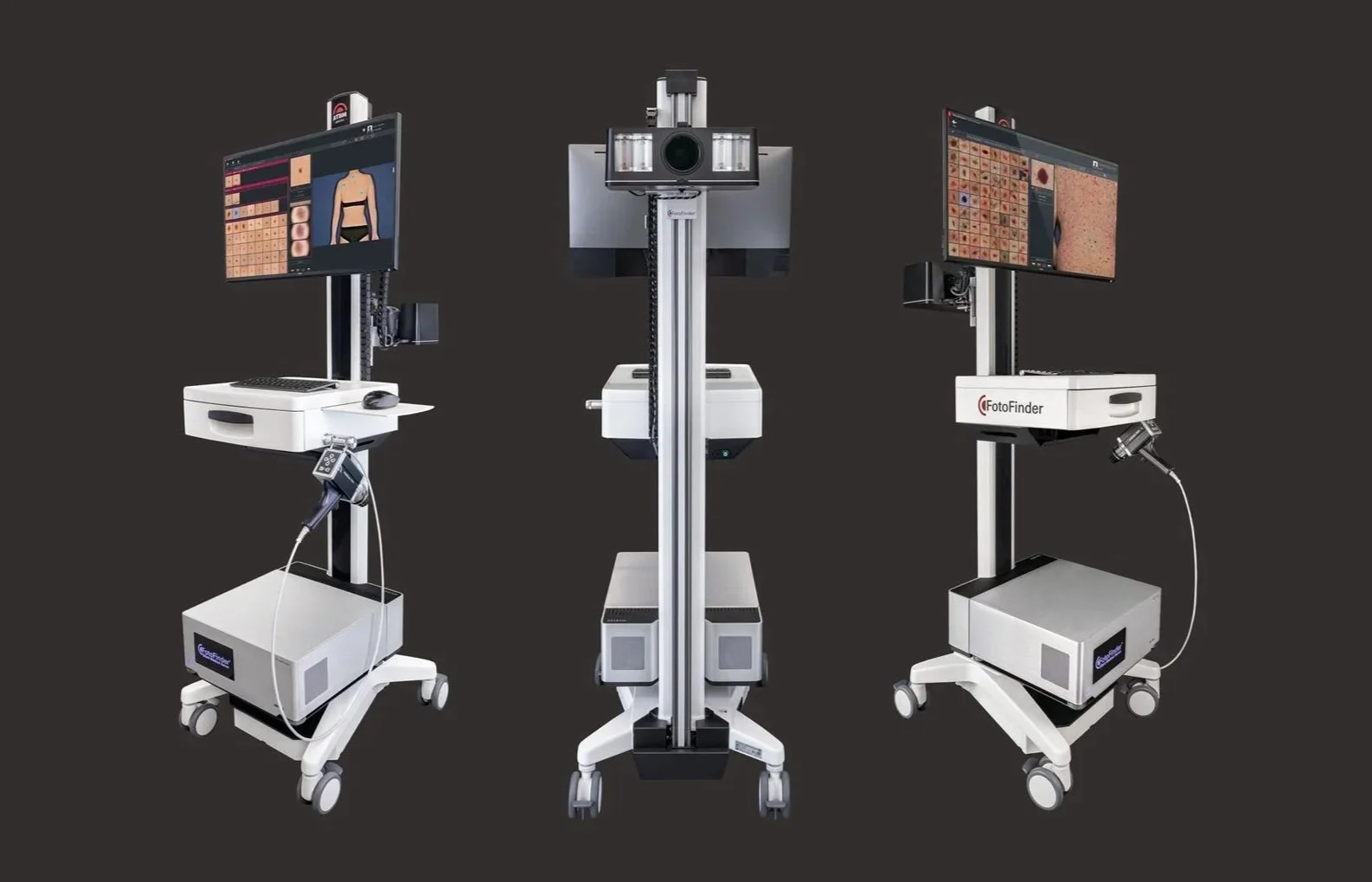 Medical imaging machines with monitors, cameras, and control panels on wheeled stands, used for skin analysis and dermatology evaluations.