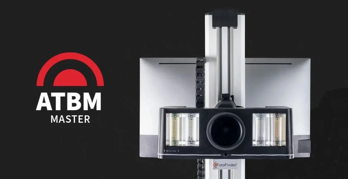 A scanning machine with a camera and batteries, positioned in front of a computer monitor and a logo that reads 'ATBM MASTER' with a red semi-circle design.