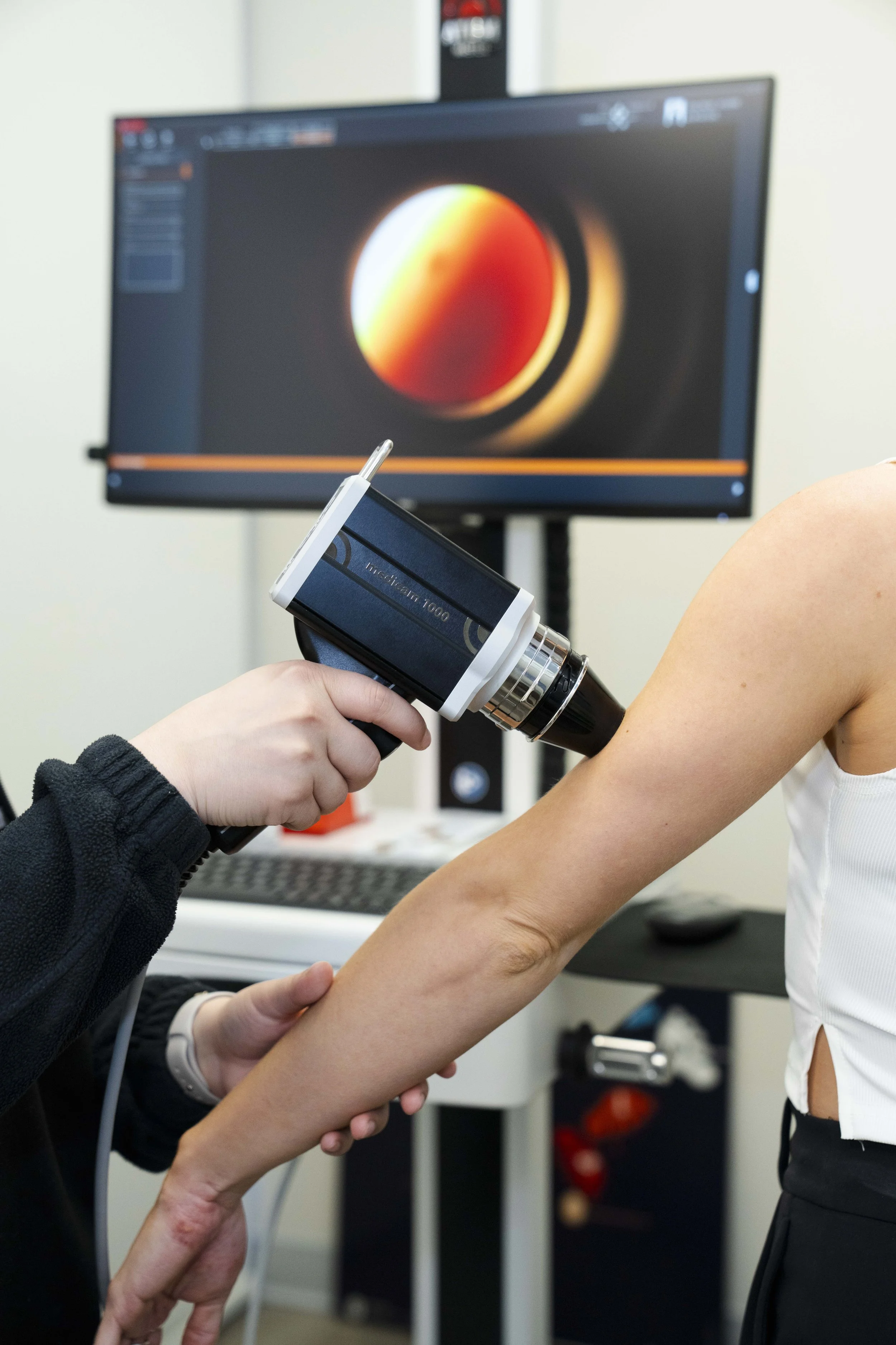 Person undergoing a skin test or examination on their arm with a medical device in a clinical setting.