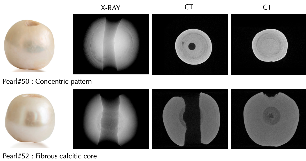 Diagram comparing X-ray and CT scans of two pearls, one with a concentric pattern and the other with a fibrous calcitic core.