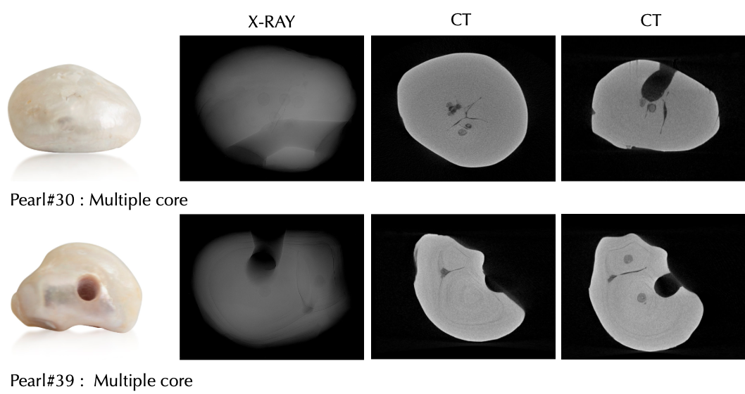 Photographs and X-ray and CT scans of two pearls, one with a single core and one with multiple cores.