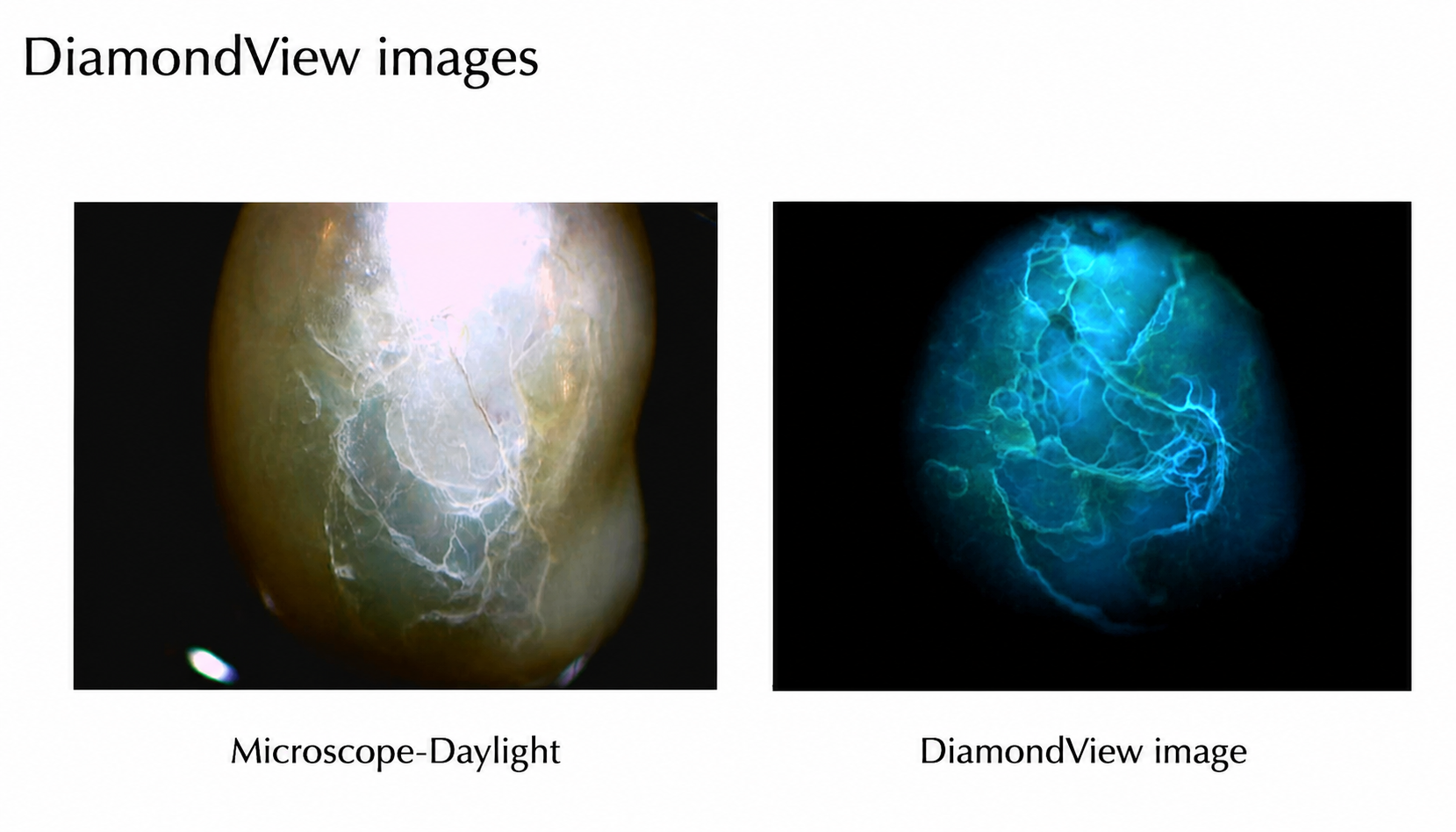 Comparison of a pearl under daylight microscope showing surface details and a DiamondView image revealing internal lightning-like structures in blue and green.