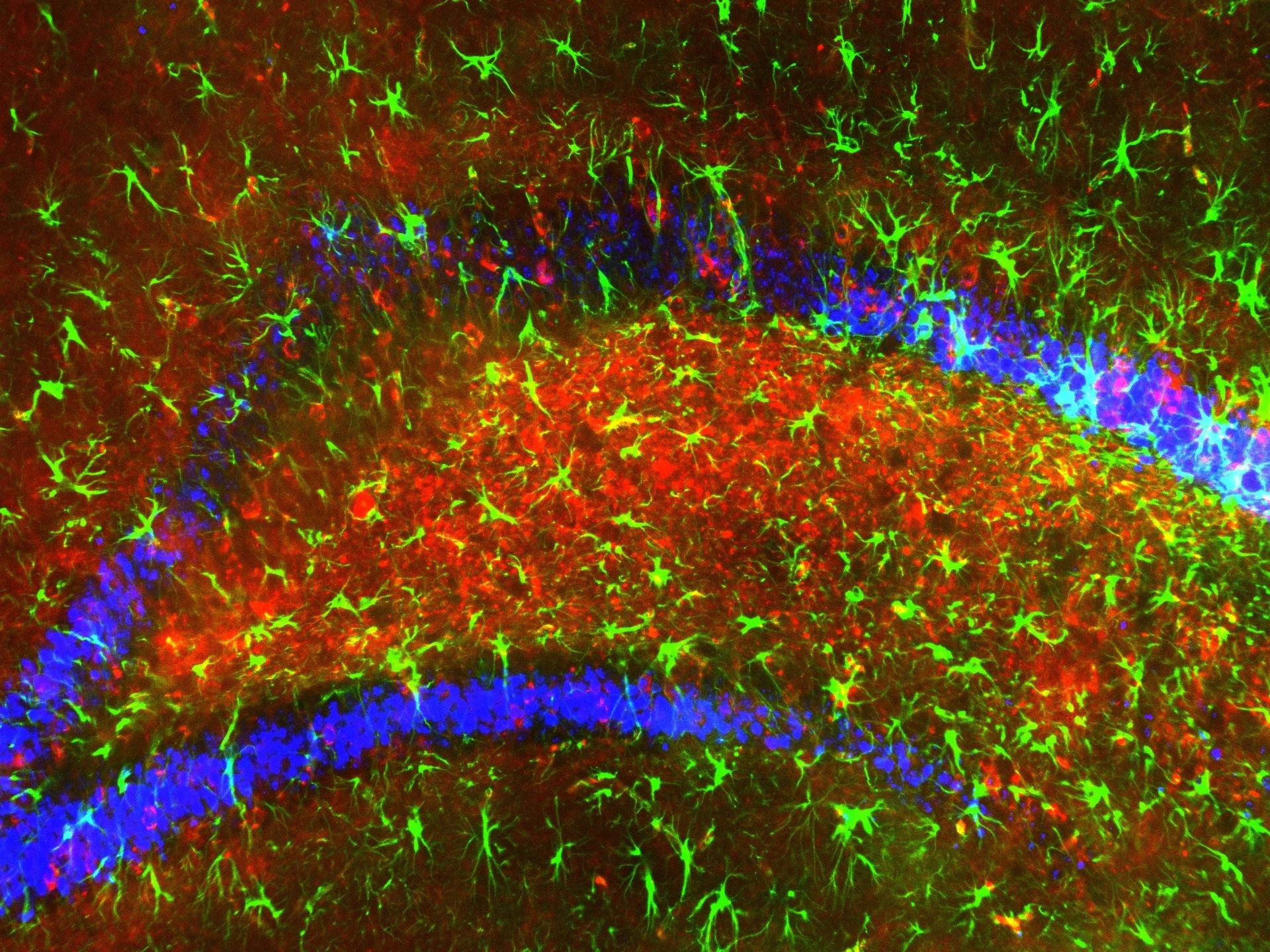 astrocyte_hippocampus.jpg