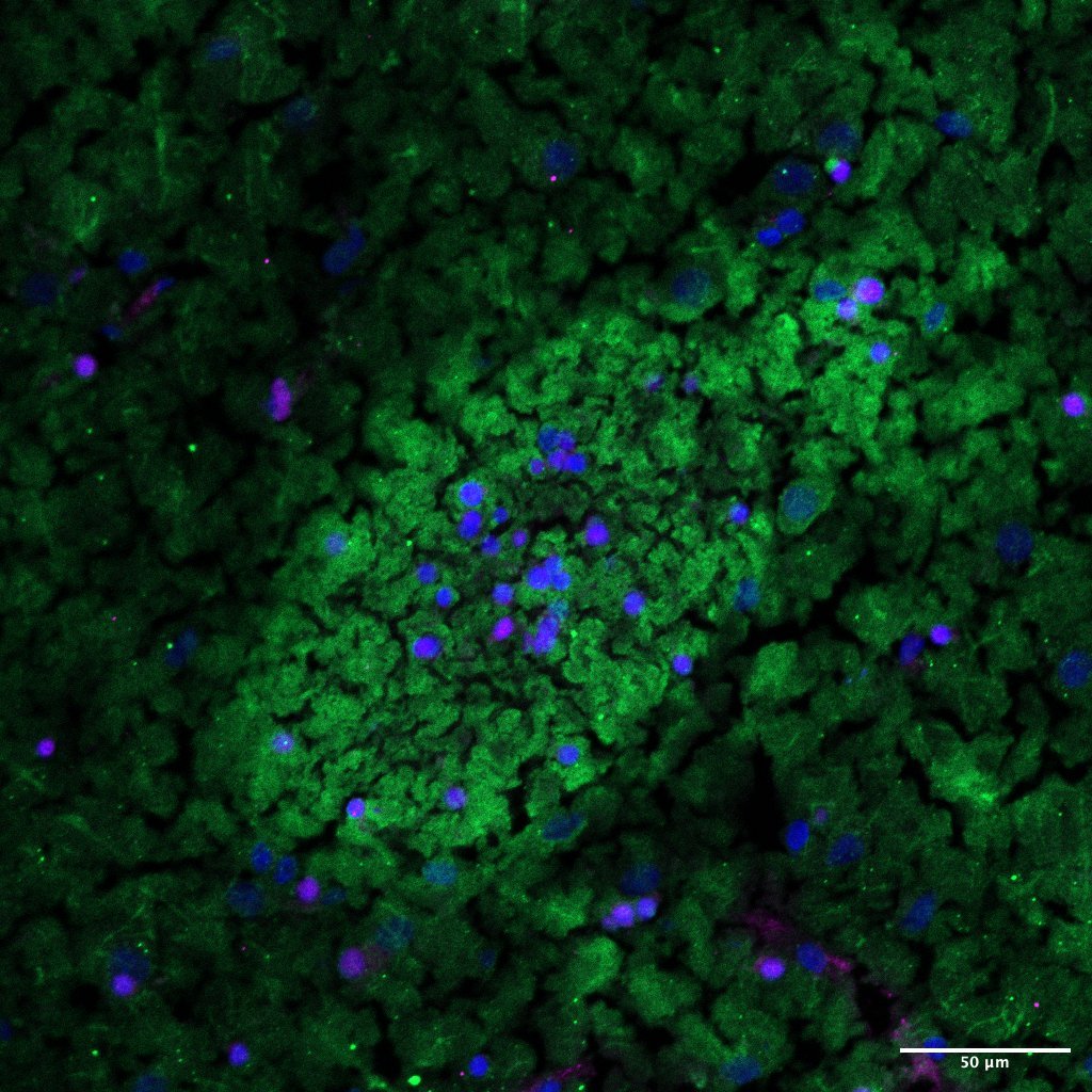 20x_mbp-sox10-dapi_CPu-striosome_02.jpg