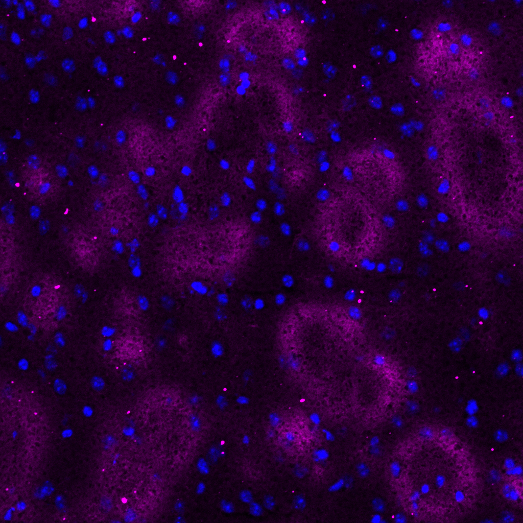 NESCRE_20x-MBP-dapi_CPu_01.png