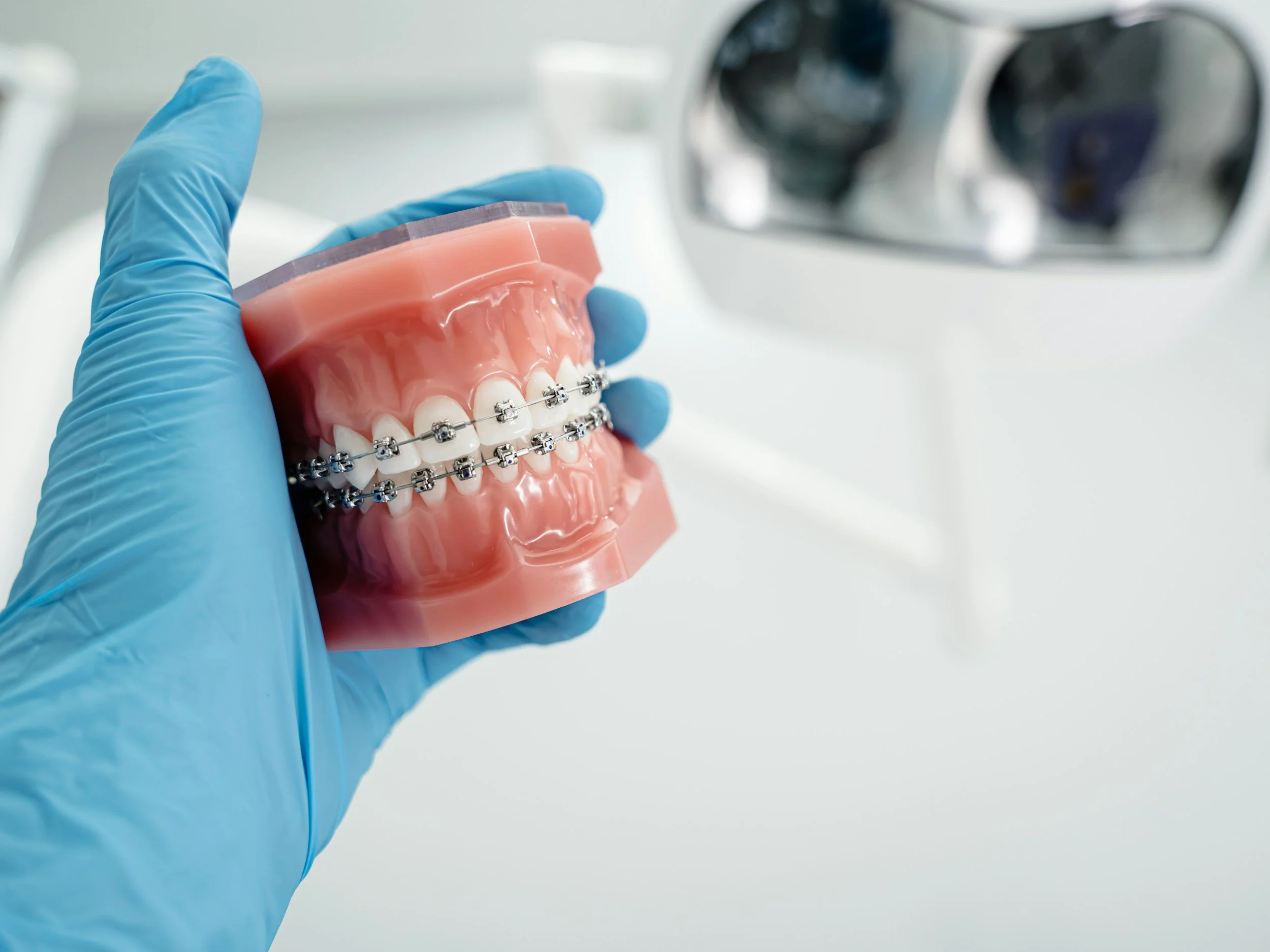 Close-up of a dental model with braces held by a person wearing blue medical gloves, with dental equipment in the background.