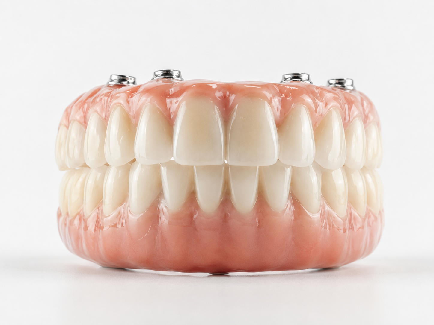 A set of artificial teeth with implants and pink gums, viewed from the front against a white background.