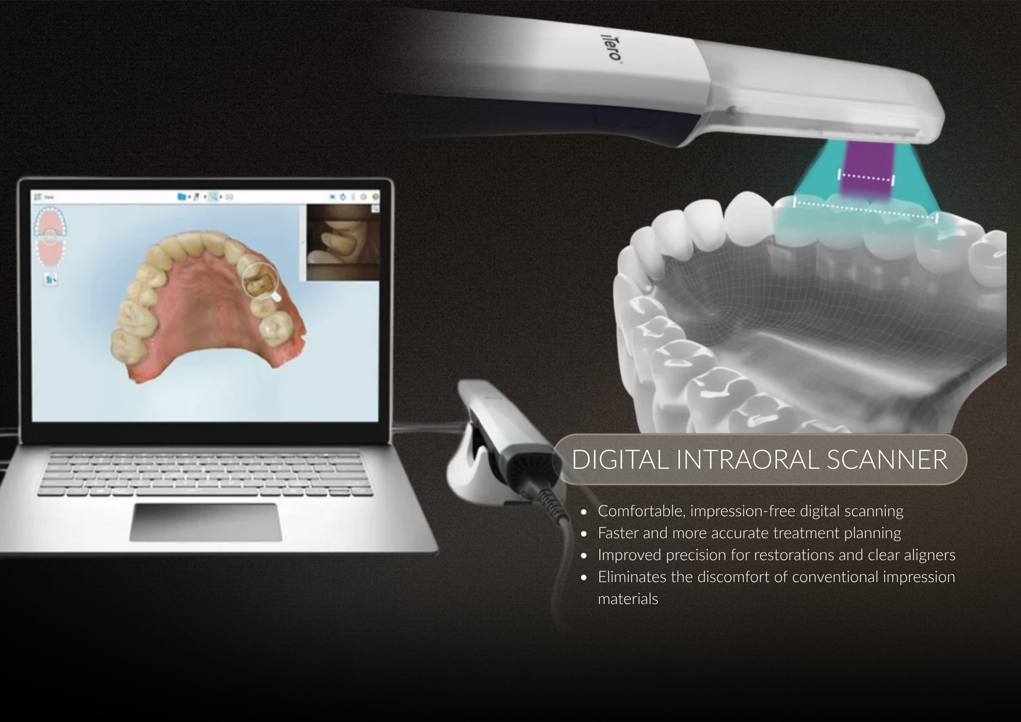 A digital intraoral scanner connected to a computer displays 3D images of dental impressions, with an overview of the scanner's features and benefits.
