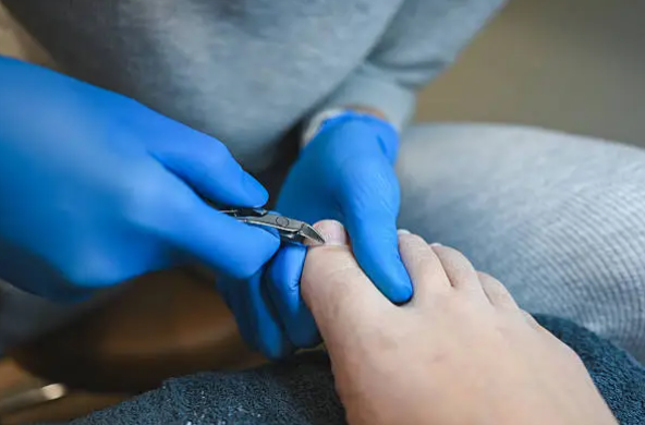 Ongle incarné : faut-il vraiment attendre que ça empire ?