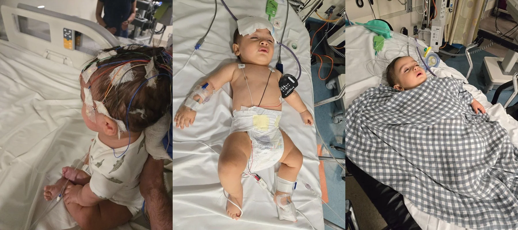 Trois enfants dans un lit d’hôpital reliés à divers moniteurs médicaux et tubes, la tête et le corps couverts ou enveloppés dans des couvertures, dans un cadre hospitalier.